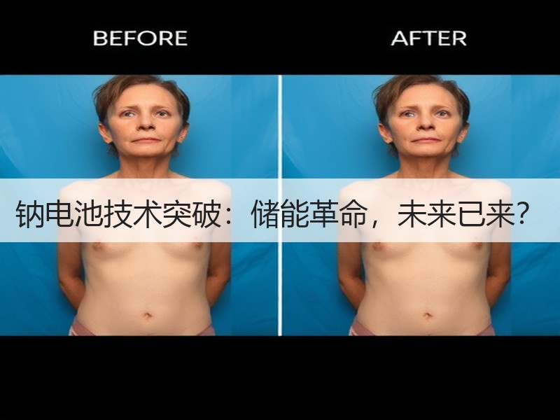 钠电池技术突破：储能革命，未来已来？